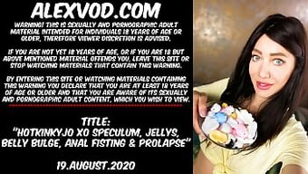 Xo Speculu...