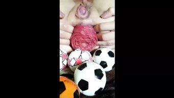 Anal Prola...